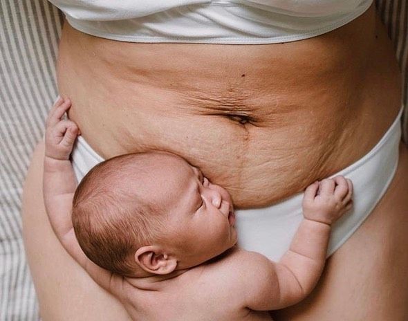 MATERNIDAD